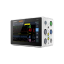 Pacientsky monitor K1